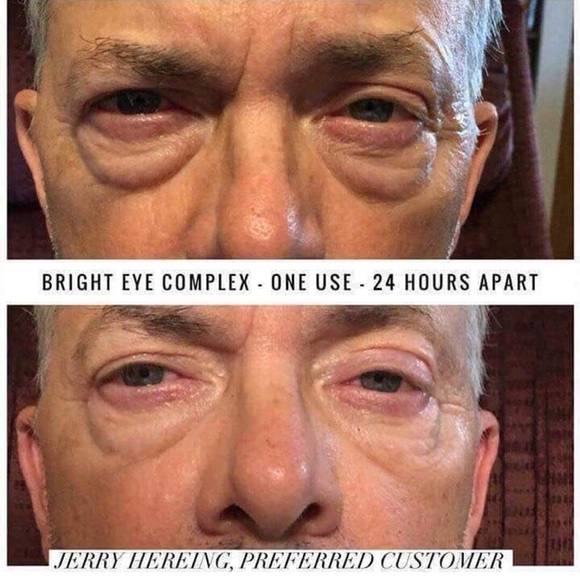 active hydration bright eye complex before and after
